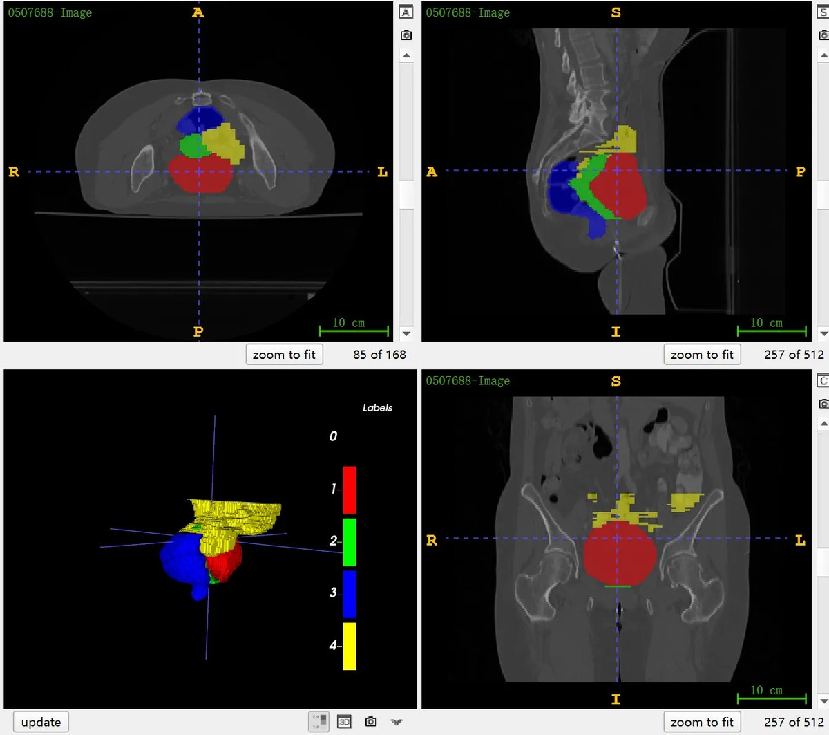BTCV_Cervix_2.webp