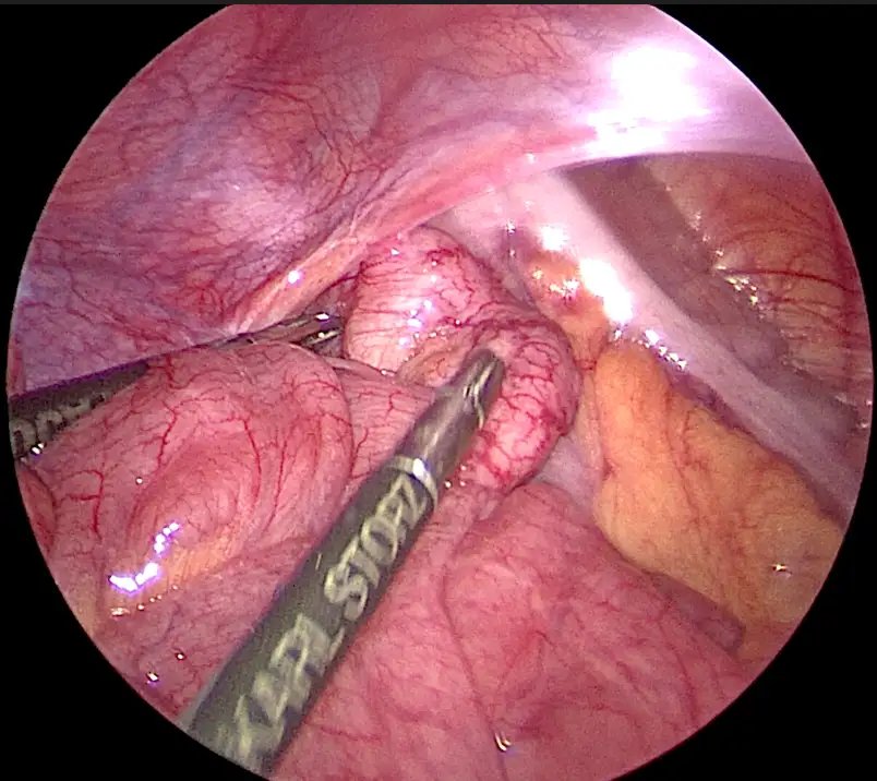 FedSurg_3.webp