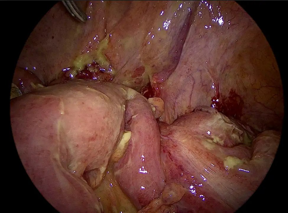 FedSurg_6.webp