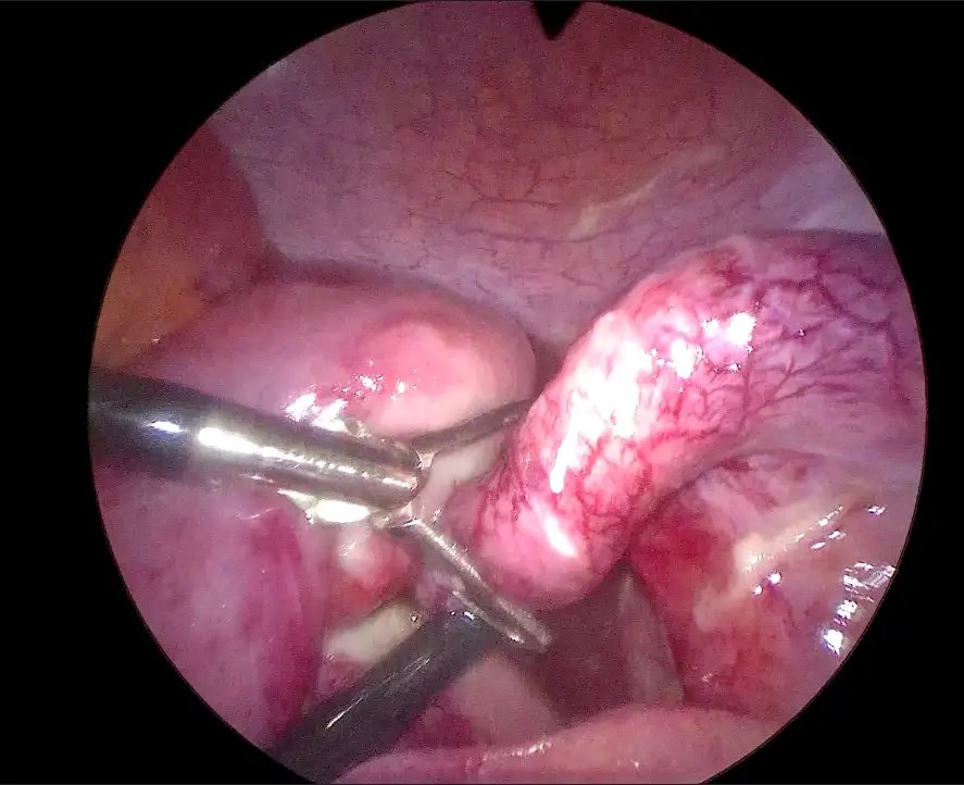 FedSurg_4.webp