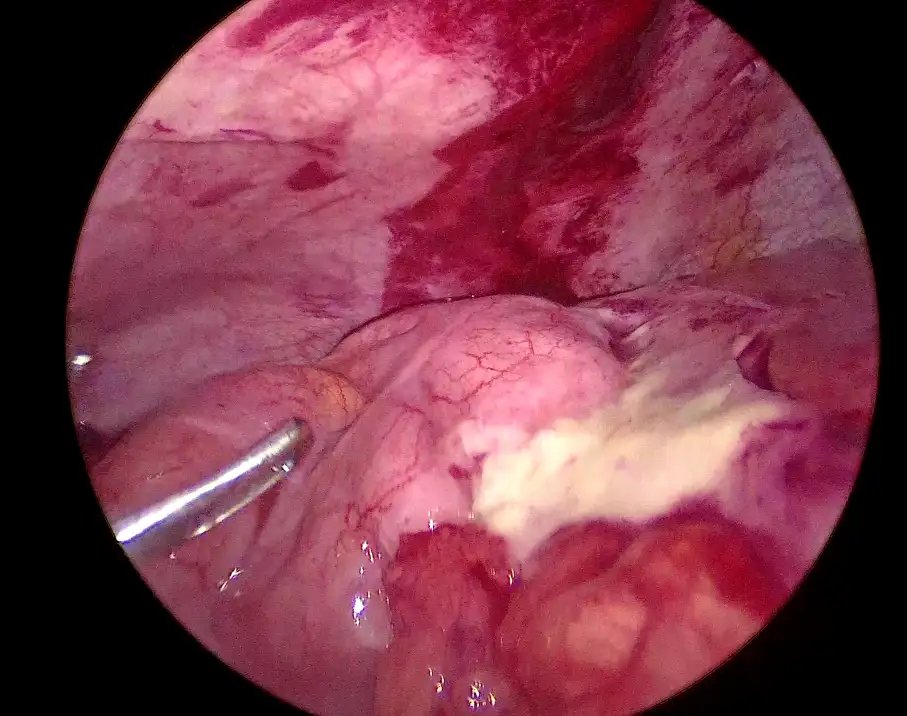 FedSurg_5.webp