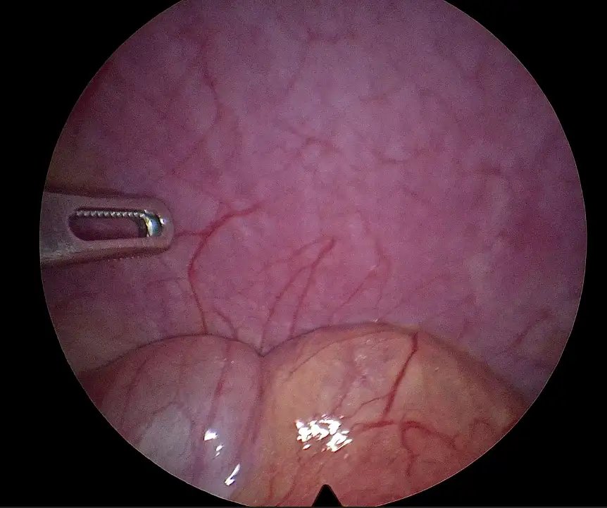 FedSurg_1.webp