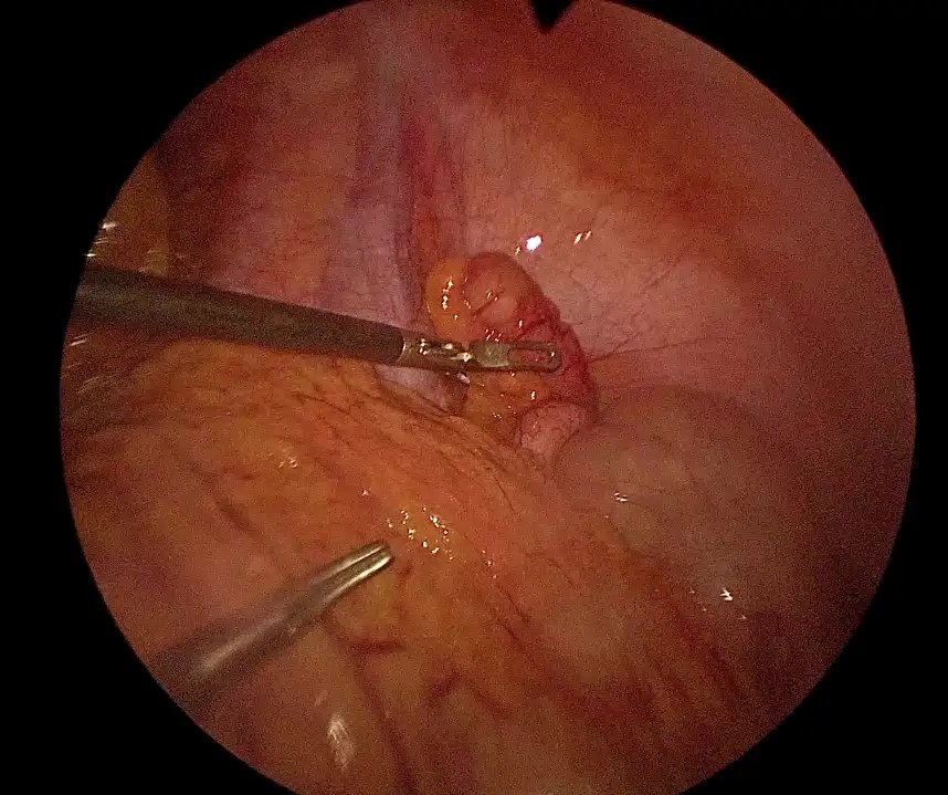 FedSurg_2.webp