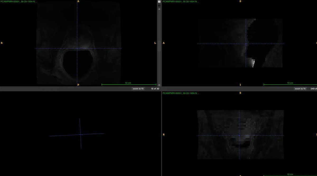 QIN-PROSTATE-Repeatability_1.webp