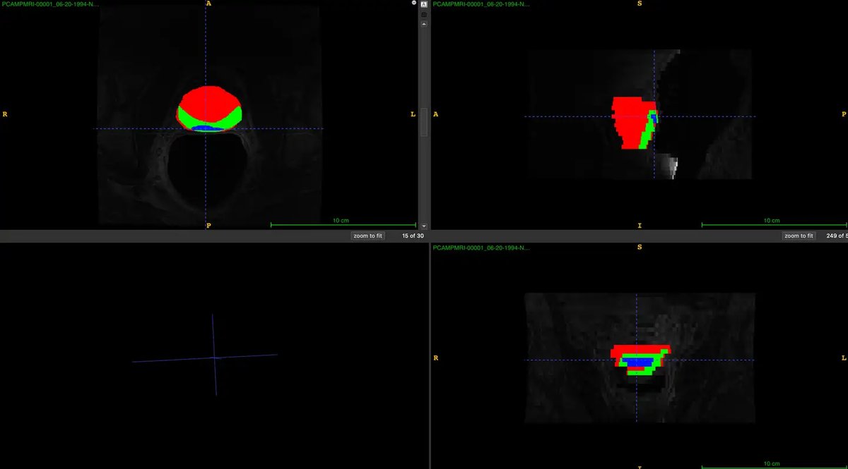 QIN-PROSTATE-Repeatability_2.webp