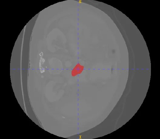 QUBIQ2021_1.webp