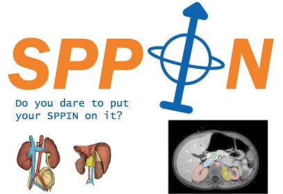 SPPIN_0.png