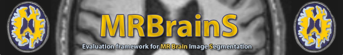 MRBrains13_0.png