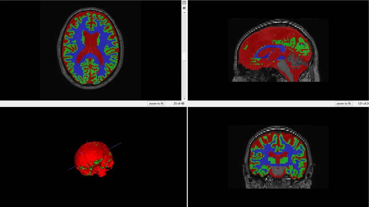 MRBrains13_1.webp