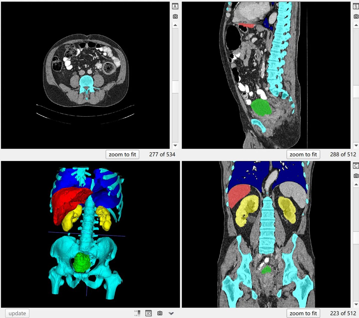 ct-org.webp