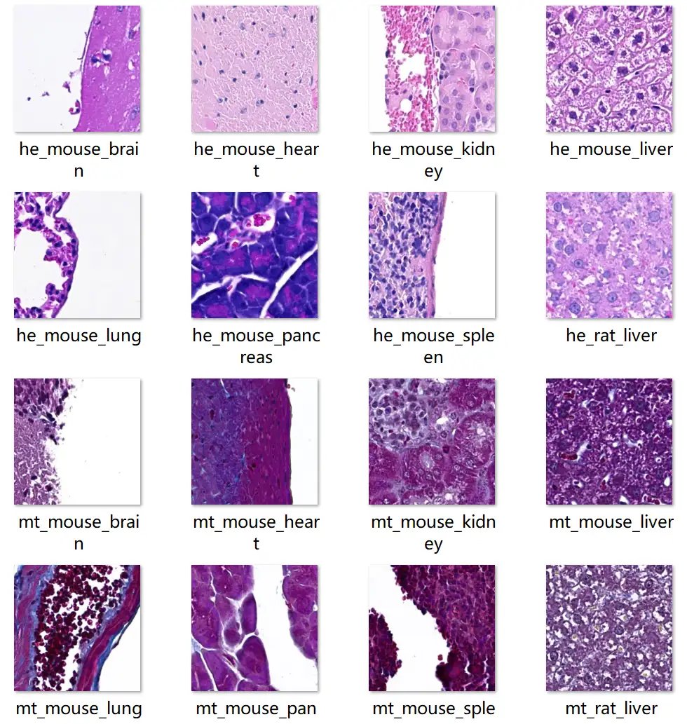 NAFLD_1.webp