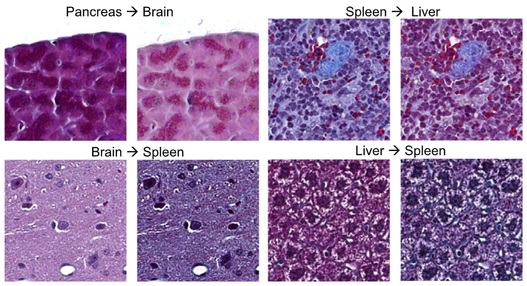 NAFLD_0.png