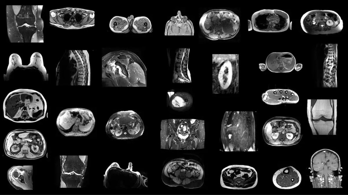 TotalSegmentator_MRI_1.webp