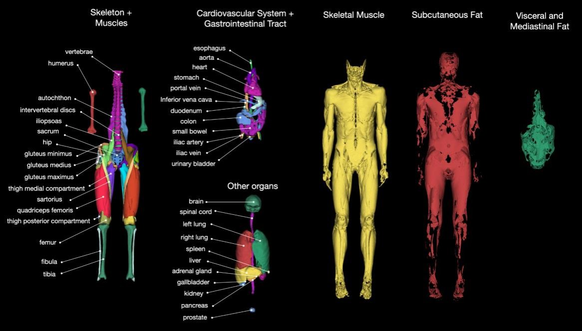 TotalSegmentator_MRI_0.png
