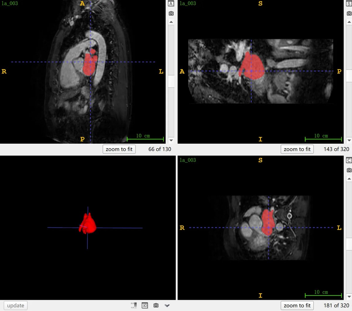 MSD_Cardiac_1.webp