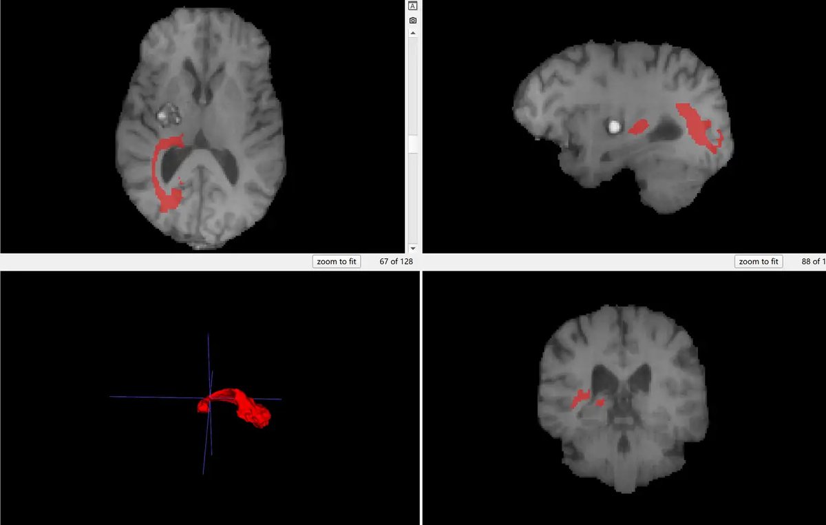 BrainPTM_1.webp