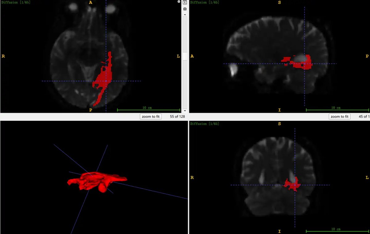 BrainPTM_2.webp