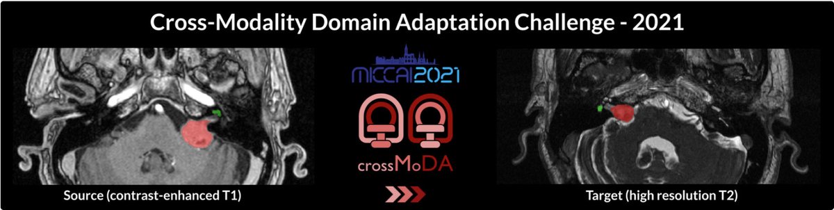 CrossMoDA2021_0.png