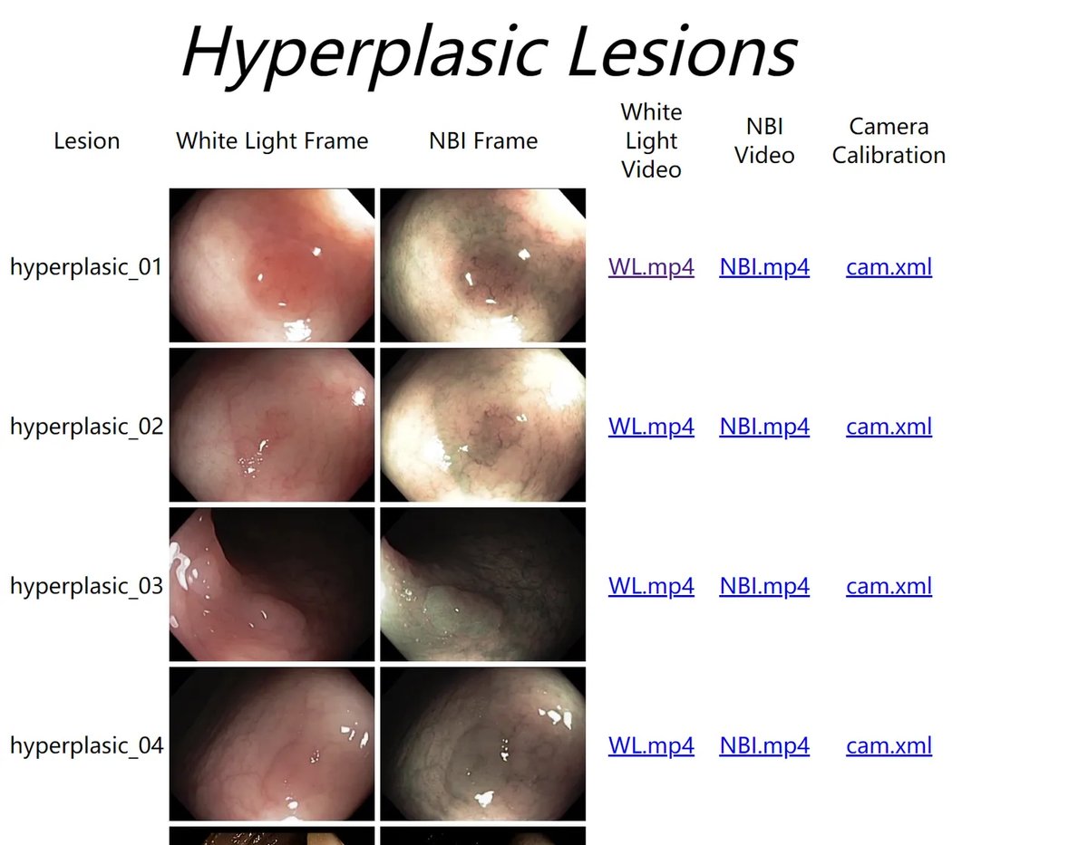 Colonoscopic_4.webp