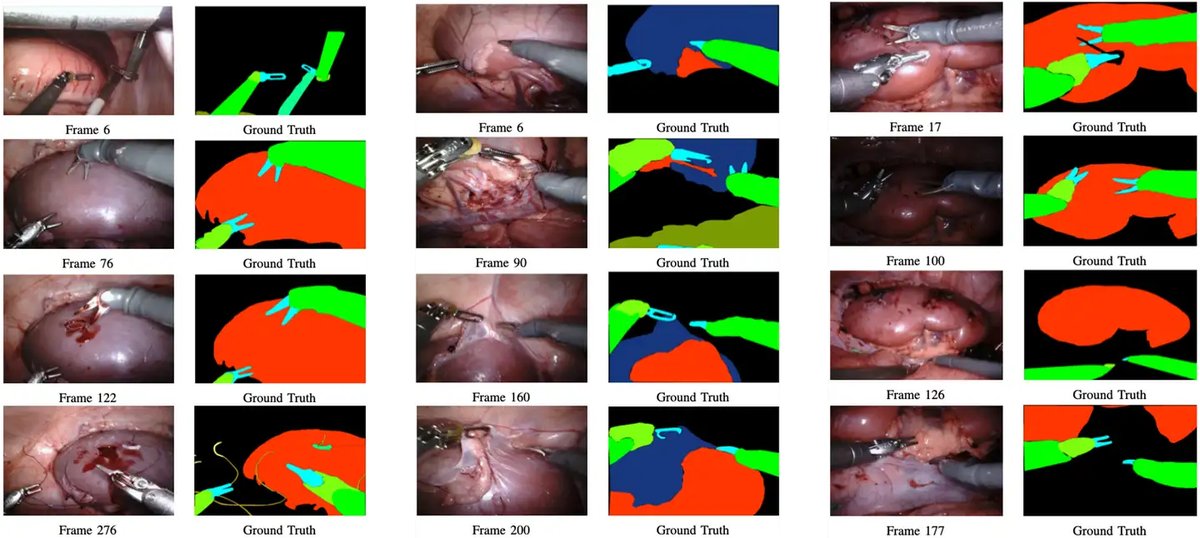 EndoVisSub2018-RoboticSceneSegmentation_1.webp