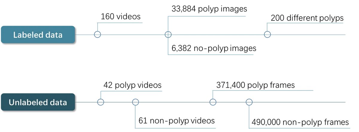 LDPolypVideo_2.webp