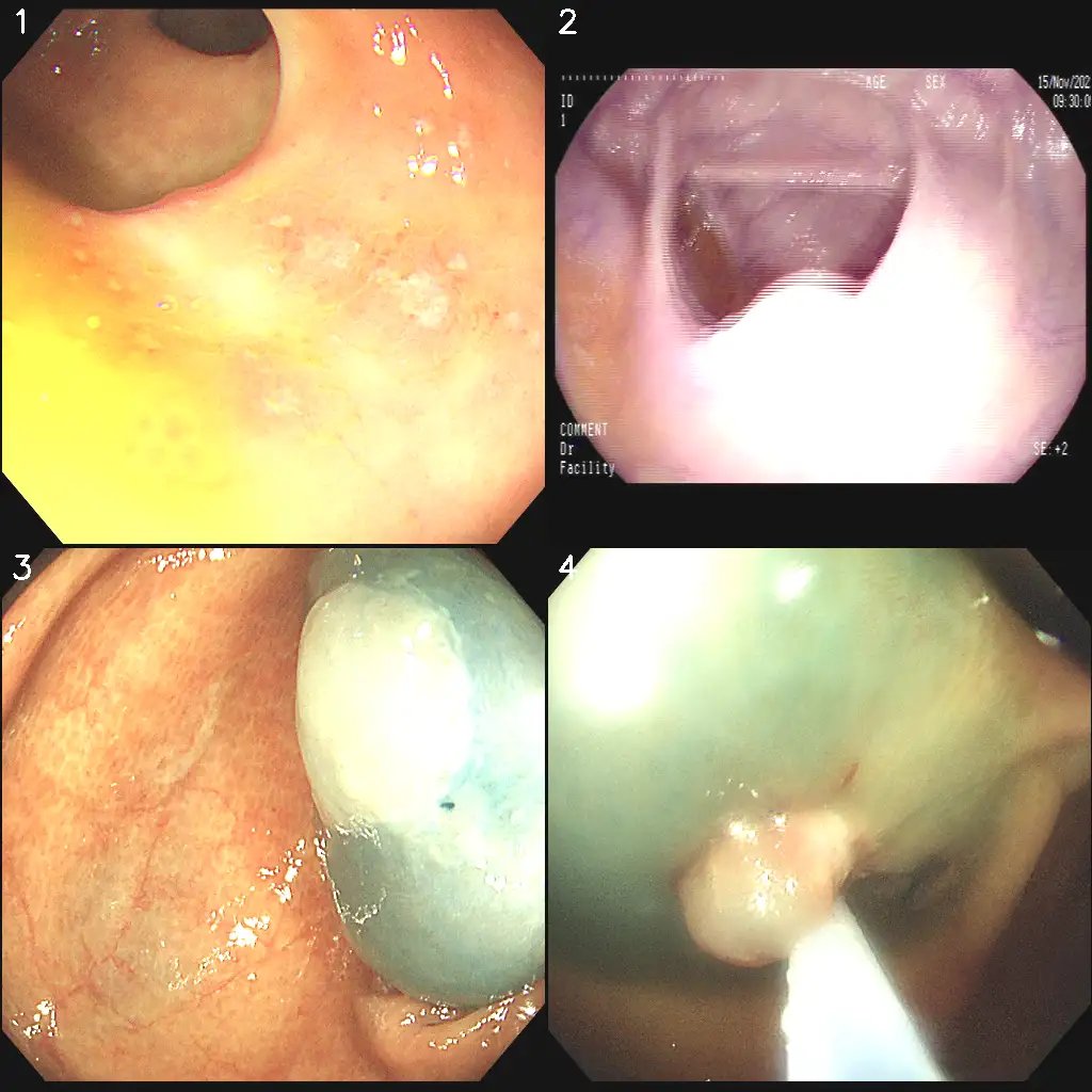 MedFM_Endo_1.webp