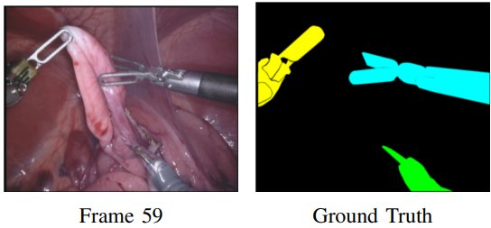Robotic_Instrument_Segmentation_0.png