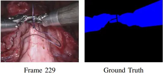Robotic_Instrument_Segmentation_1.webp