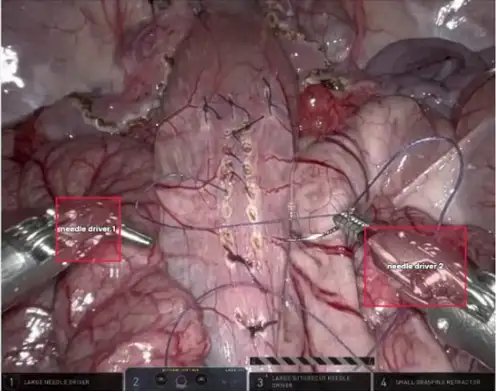 SurgVU24_3.webp
