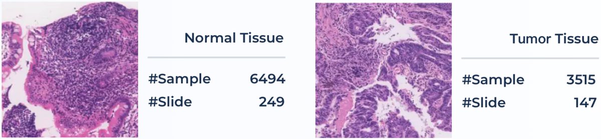 MedFM_Colon_0.png