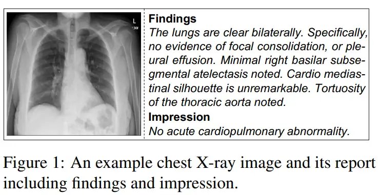 IU-Xray_1.webp