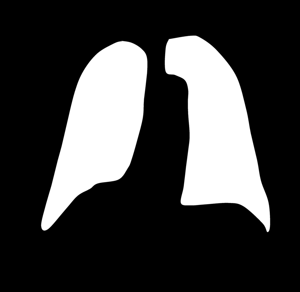 SZ-CXR_2.png
