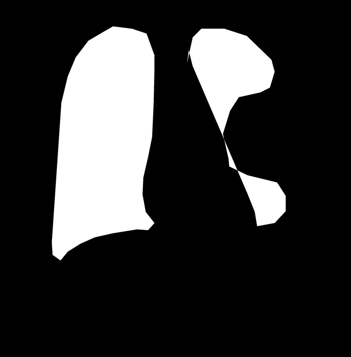SZ-CXR_4.png