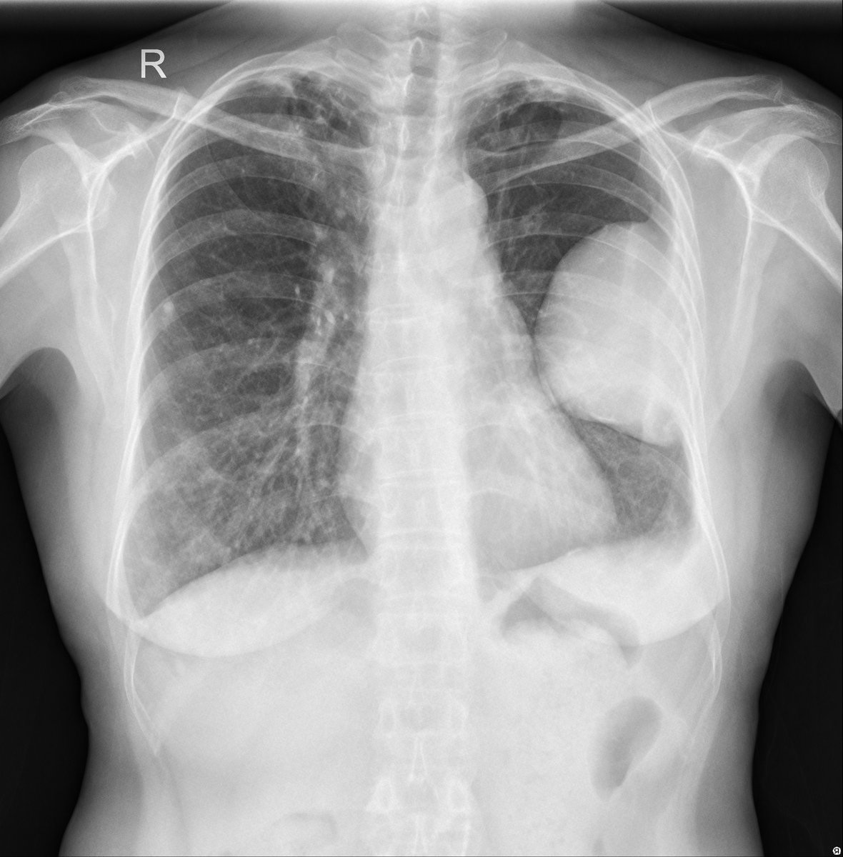 SZ-CXR_3.png