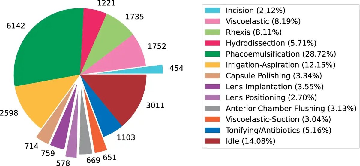 Cataract-1K_2.webp