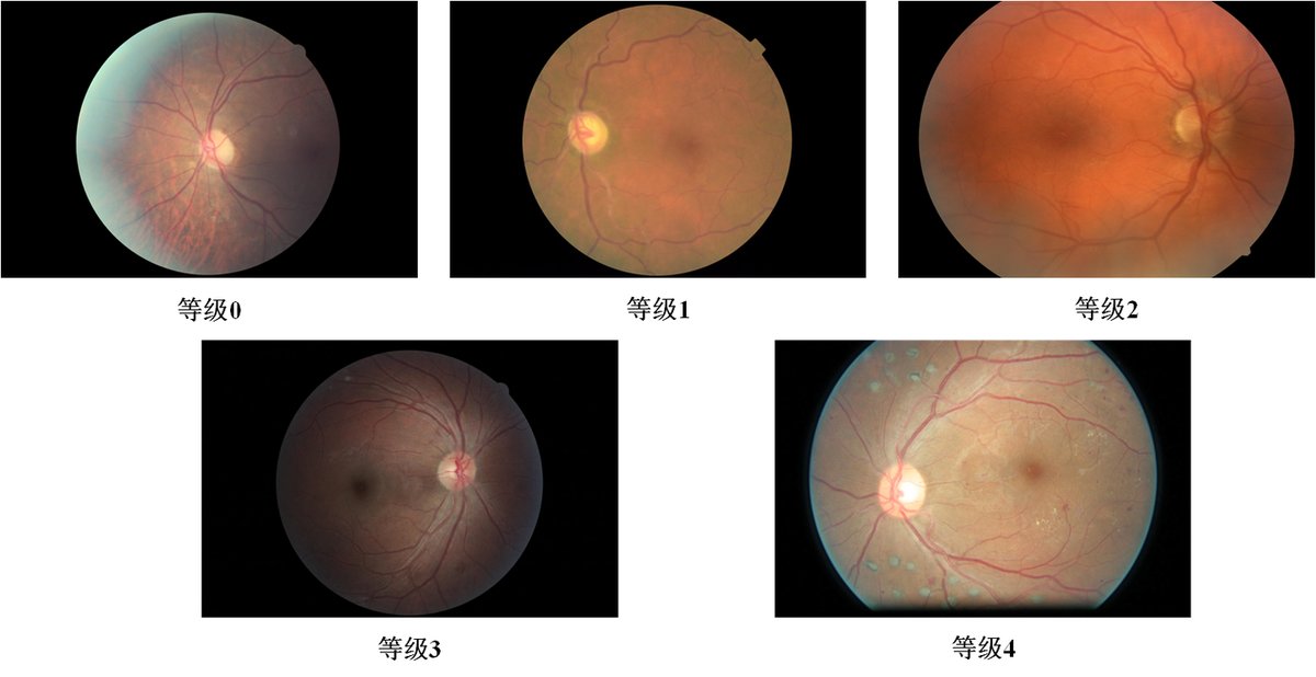 Eyepacs_0.png