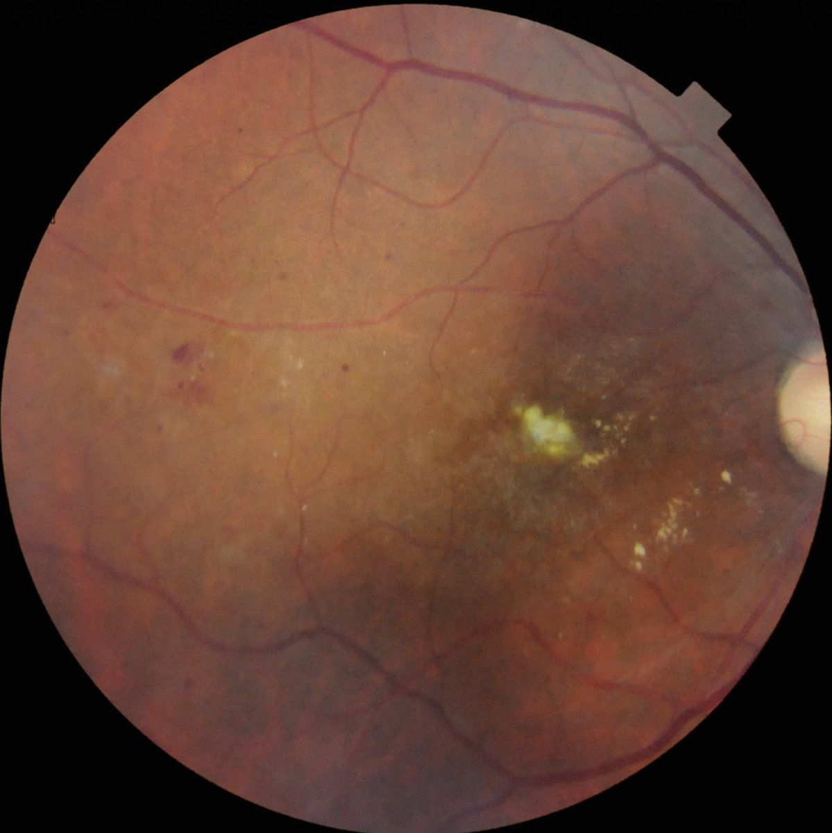 Multi-LabelRetinalDiseases_0.png