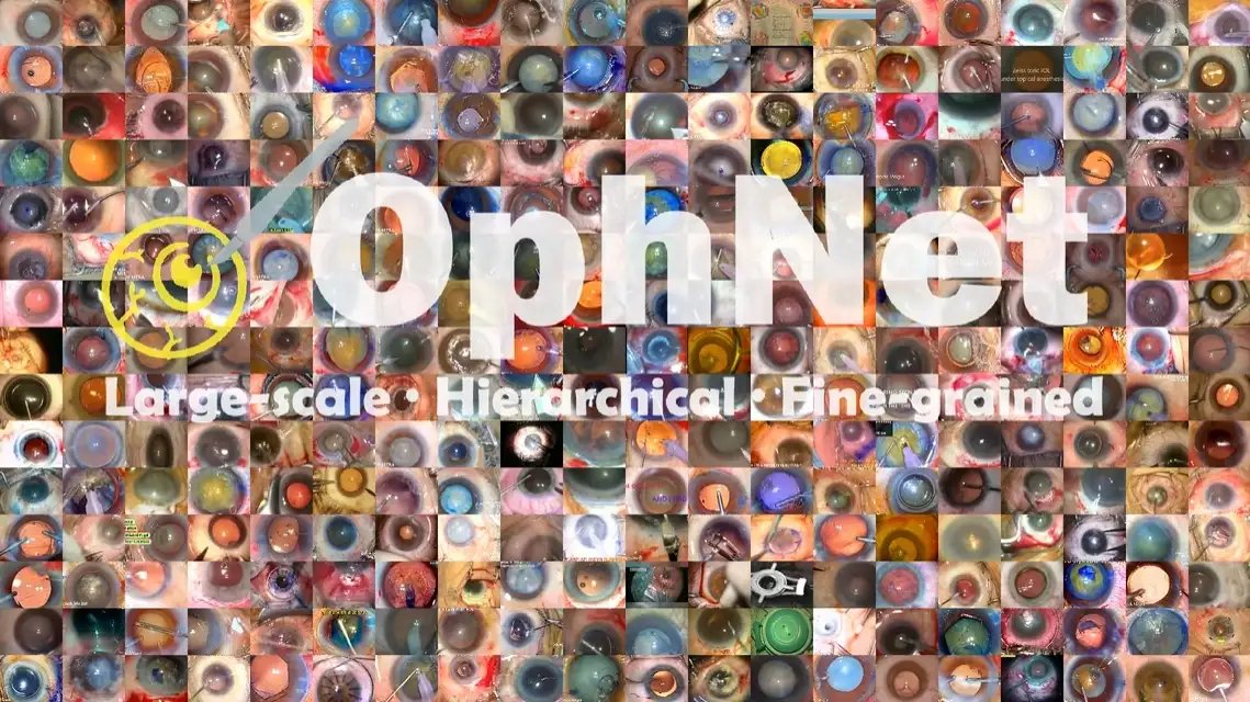 OphNet_0.webp