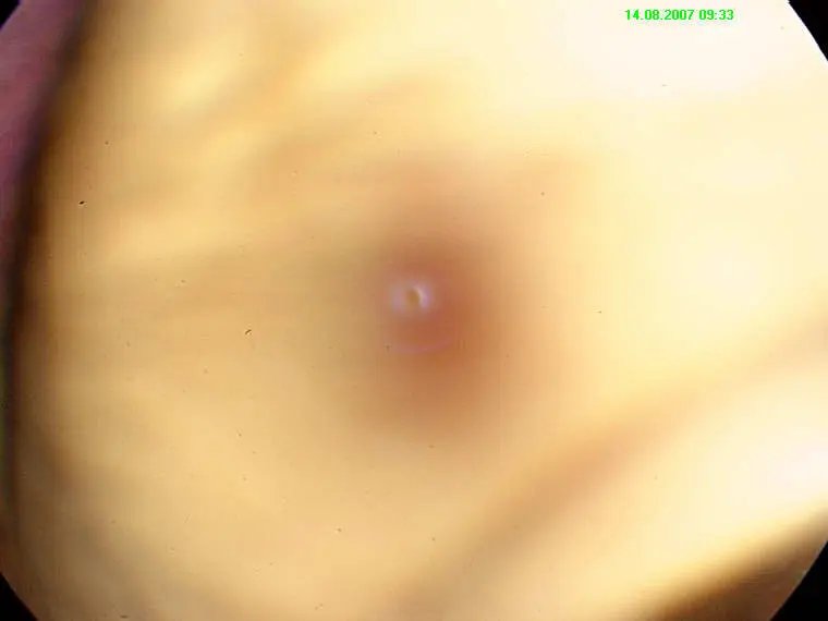 Retinal_QA_3.webp